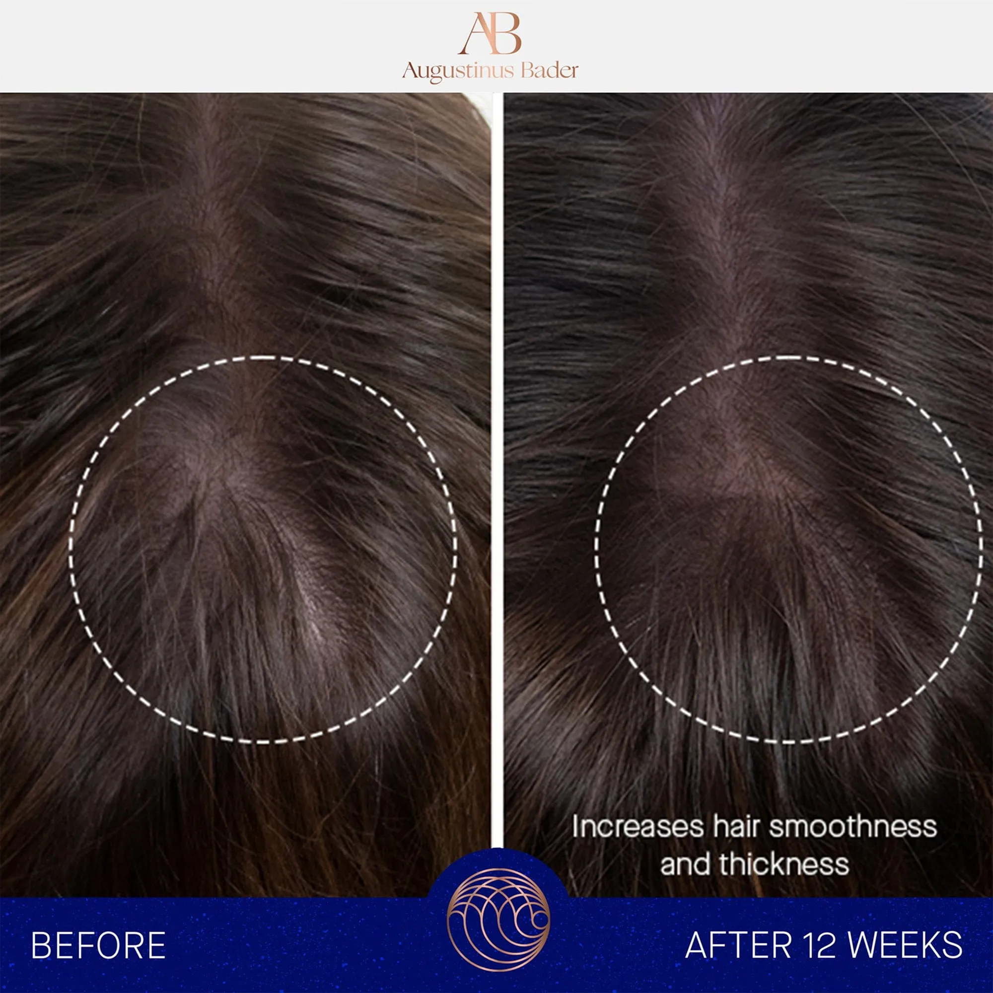 THE LEAVEIN HAIR TREATMENT AUGUSTINUS BADER ACONDICIONADOR EN SECO